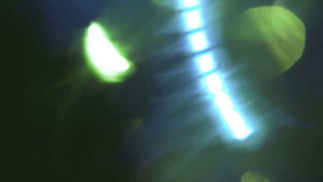 Mixed Light Leaks Bokeh 00370